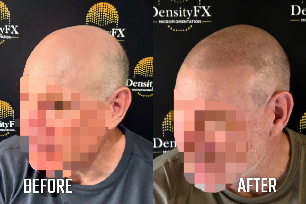before and after(1)-1