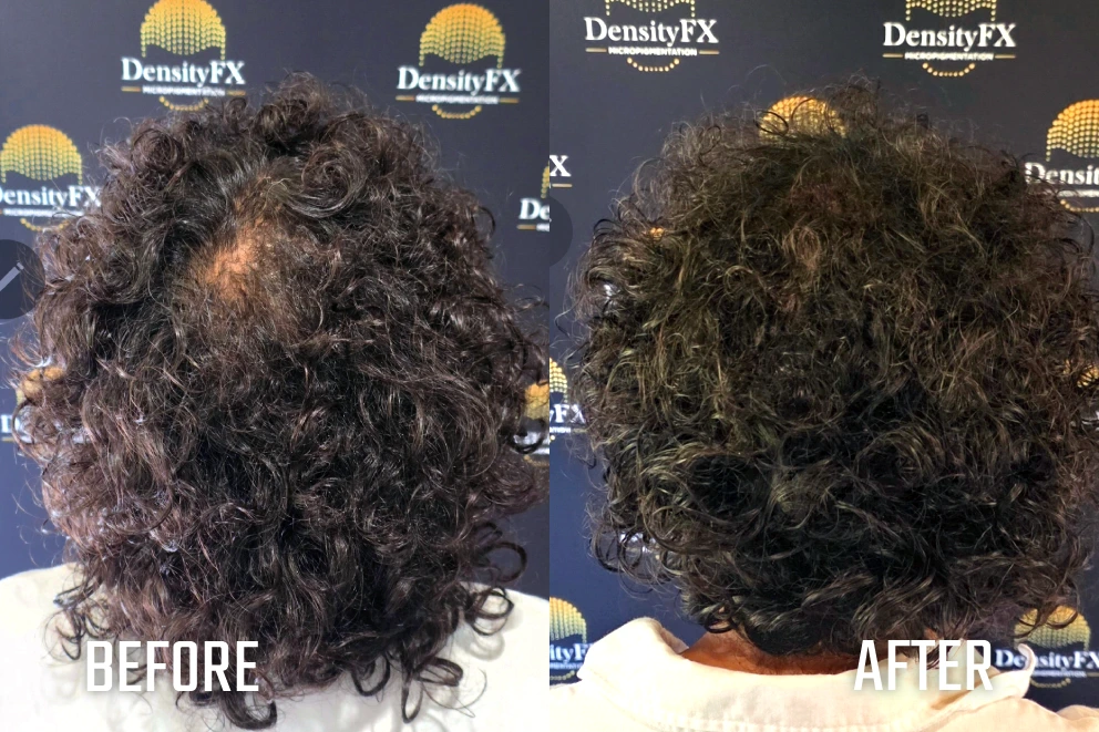 before and after(1)-3