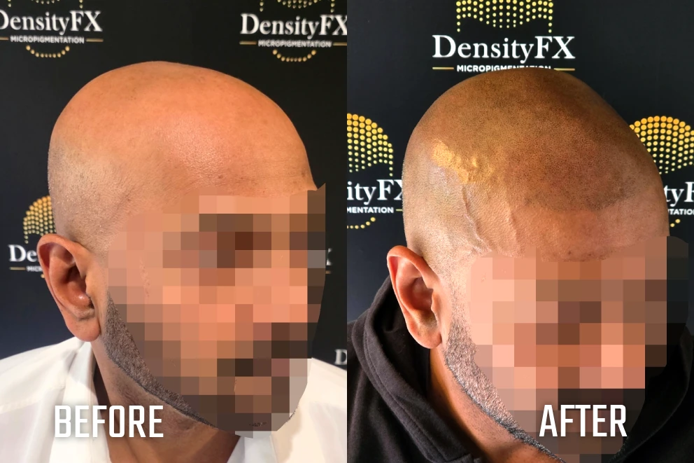 before and after(1)-4
