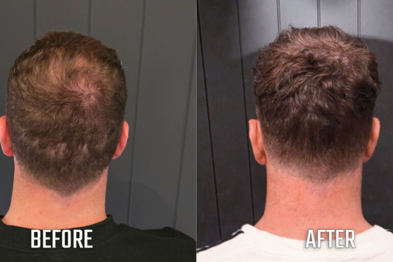 before and after(14)