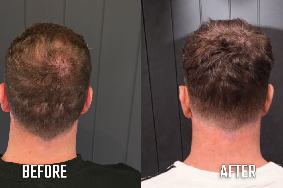 before and after(14)