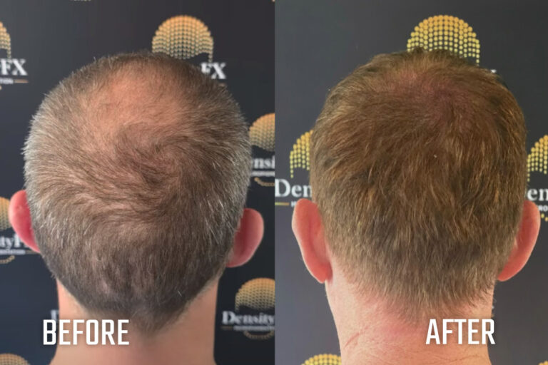 before and after(16)